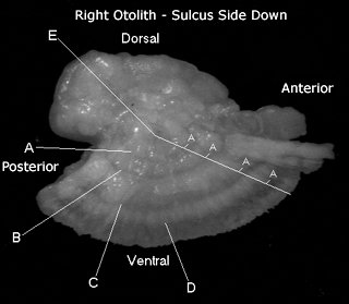 Aging Otolith