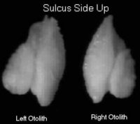sulcus side up